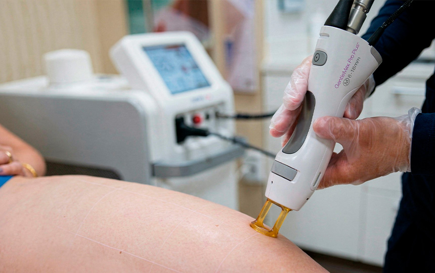 The Truth About Laser Hair Removal Pain: What to Expect During Your Treatment