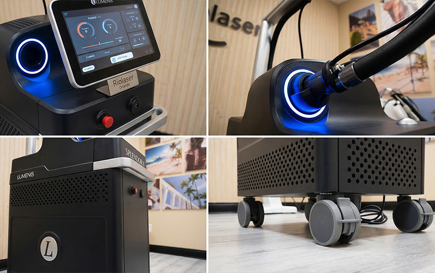 How the SplendorX Machine is Revolutionizing Laser Hair Removal at Riolaser Orlando