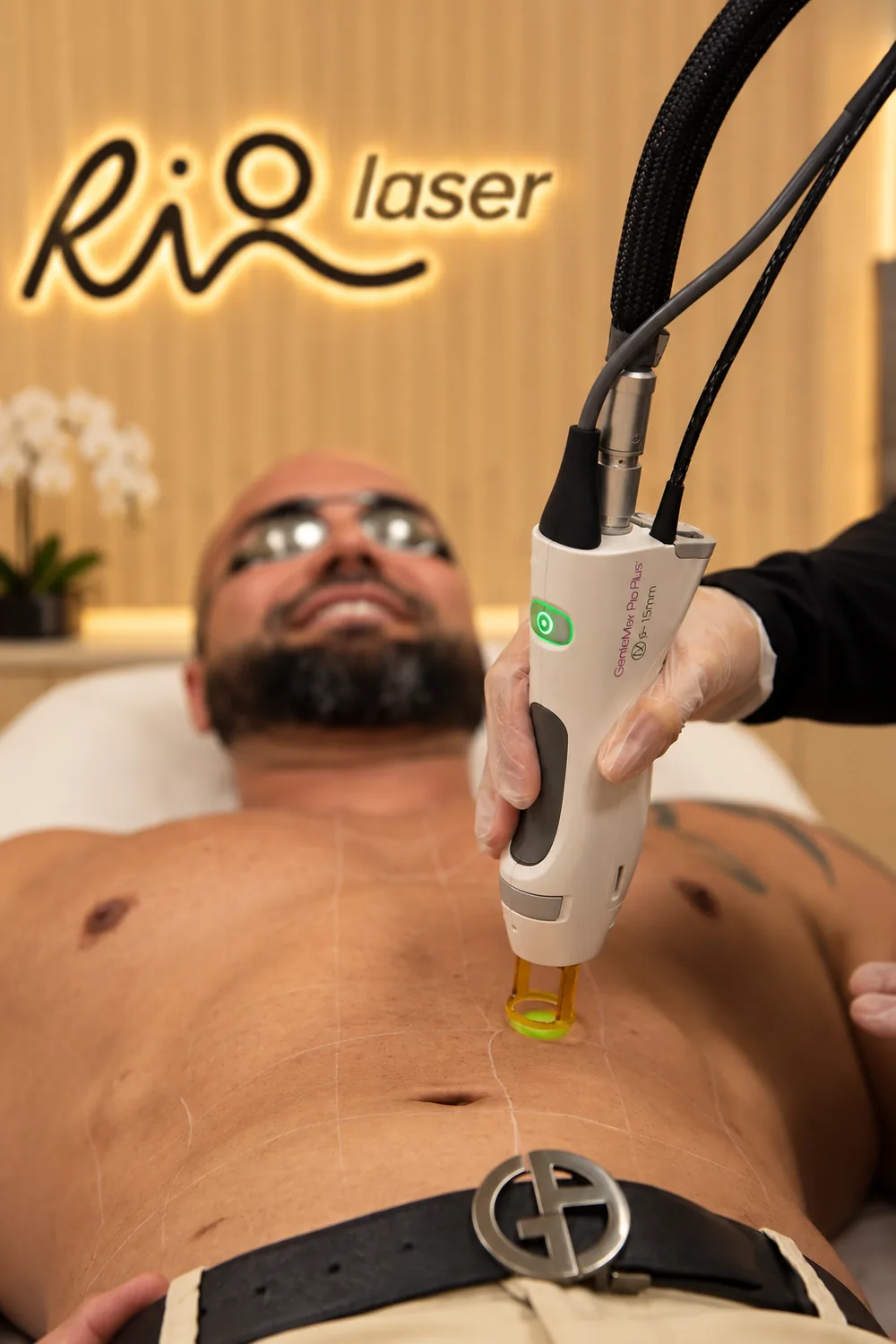 Chest and abdomen laser hair removal for men at Riolaser Ocoee