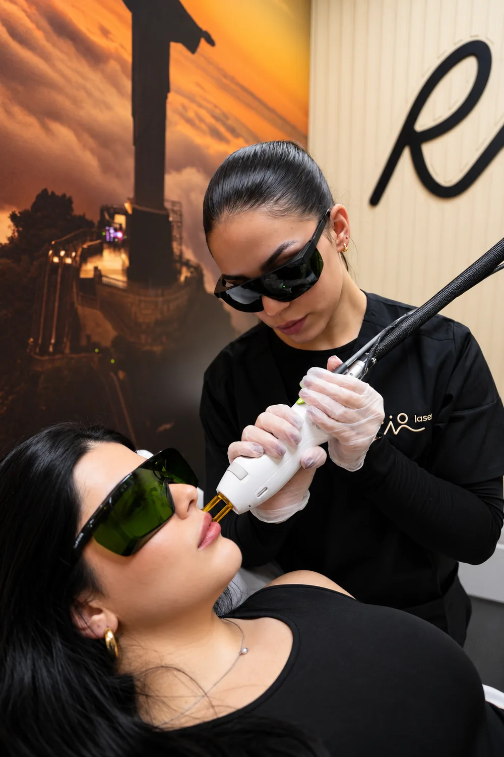 Upper lip laser hair removal at Riolaser Kissimmee